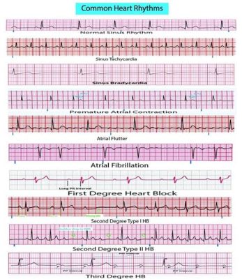 Rhythm Doctor!  A Heartbeat-Pumping Odyssey Through Quirky Medical Mishaps