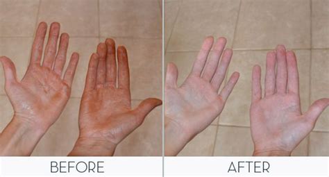 How to Get Spray Tan Off Hands Quickly: A Comprehensive Guide